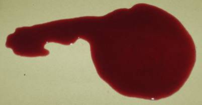 blood (file Pic)