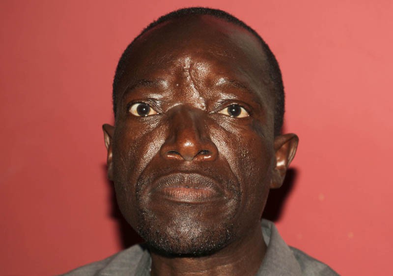 After senseless attack Makhulu is left with a depressed face 