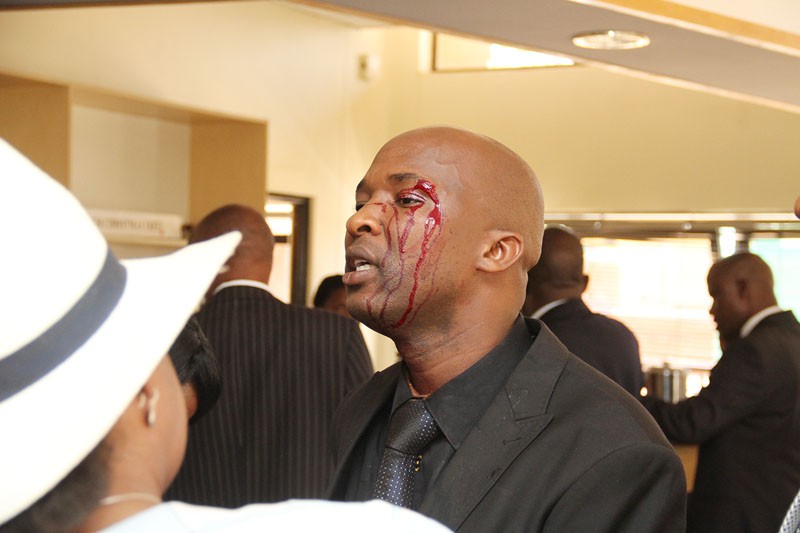 Selala shortly after the assault PIC: KAGISO ONKATSWITSE