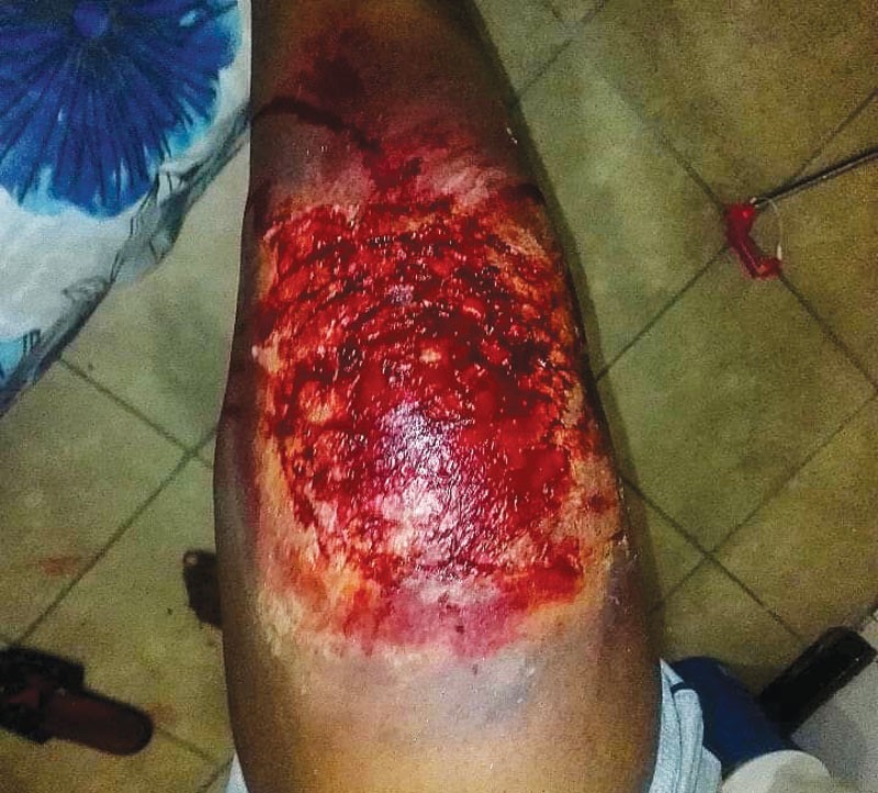 Hildah's special effects makeup