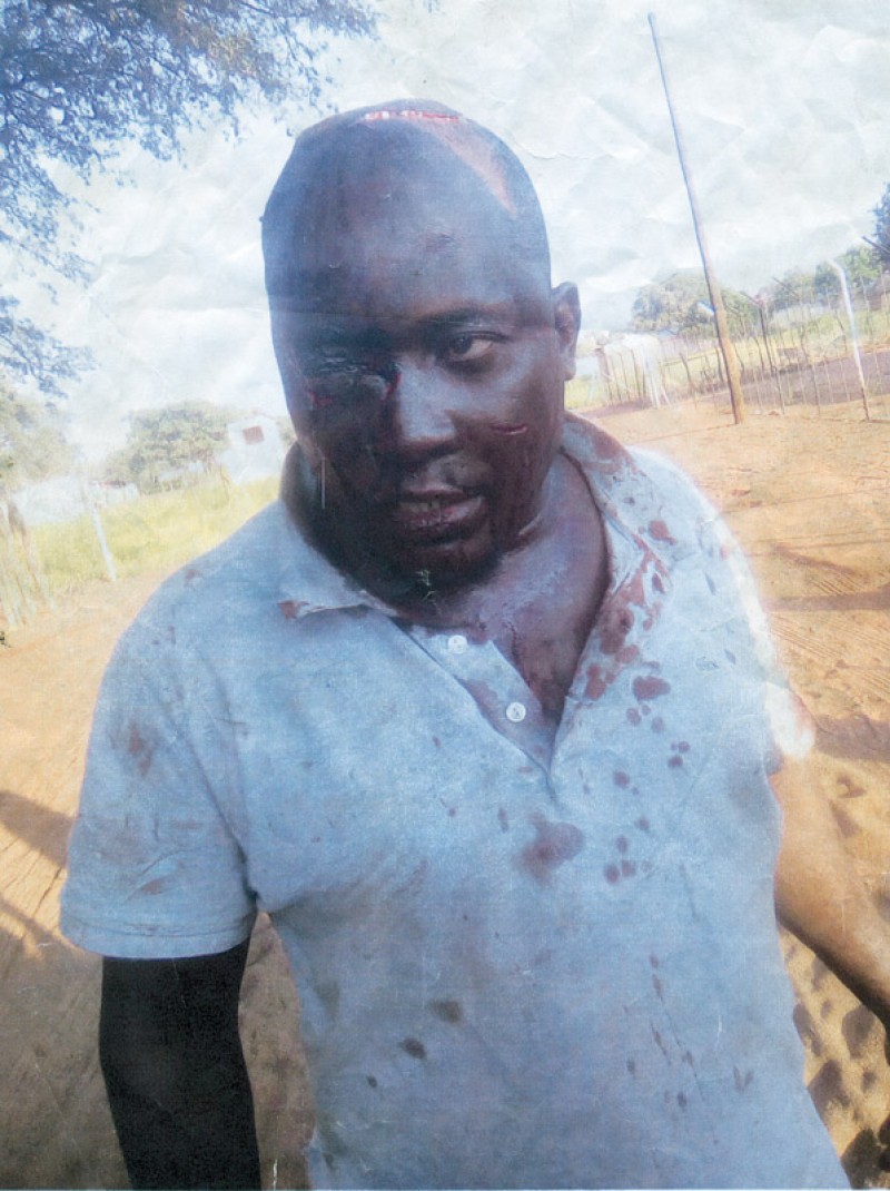 Ofentse Humu fought the Leopard with his bare hands