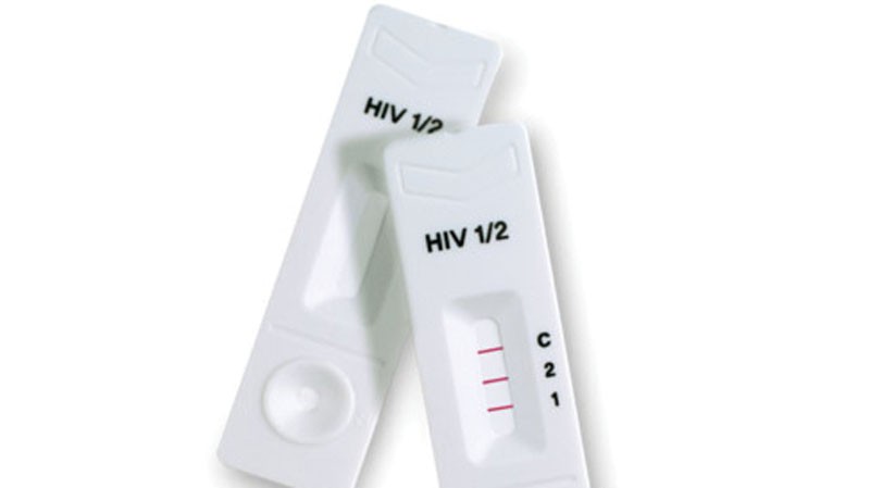 HIV test kit